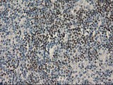UBXN2B Antibody - IHC of paraffin-embedded Human lymphoma tissue using anti-UBXN2B mouse monoclonal antibody. (Heat-induced epitope retrieval by 10mM citric buffer, pH6.0, 100C for 10min).