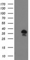 UBXN2B Antibody - HEK293T cells were transfected with the pCMV6-ENTRY control (Left lane) or pCMV6-ENTRY UBXN2B (Right lane) cDNA for 48 hrs and lysed. Equivalent amounts of cell lysates (5 ug per lane) were separated by SDS-PAGE and immunoblotted with anti-UBXN2B.