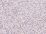 UCK1 Antibody - Immunochemical staining of human UCK1 in human liver with rabbit polyclonal antibody at 1:500 dilution, formalin-fixed paraffin embedded sections.