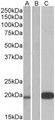 UCN3 / SPC Antibody - HEK293 lysate (10ug protein in RIPA buffer) over expressing Human UCN3 with DYKDDDDK tag probed with (1ug/ml) in Lane A and probed with anti- DYKDDDDK Tag (1/3000) in lane C. Mock-transfected HEK293 probed (1mg/ml) in Lane B. Primary