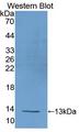 UCP1 / UCP-1 Antibody