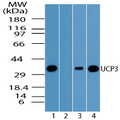 UCP3 Antibody - Western blot of UCP3 in human heart lysate in the 1) absence and 2) presence of immunizing peptide, 3) mouse heart and 4) rat heart using Polyclonal Antibody to UCP3 at 1.0 ug/ml.