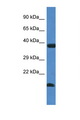 UEV1 / UEV1A Antibody - UBE2V1 antibody Western blot of Fetal Liver lysate. Antibody concentration 1 ug/ml.  This image was taken for the unconjugated form of this product. Other forms have not been tested.