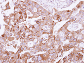 UFD1L Antibody - IHC of paraffin-embedded H441 xenograft using UFD1L antibody at 1:500 dilution.