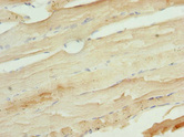 UFD1L Antibody - Immunohistochemistry of paraffin-embedded human skeletal muscle tissue at dilution 1:100