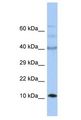 UFSP1 Antibody - UFSP1 antibody Western Blot of Fetal Small Intestine. Antibody dilution: 1 ug/ml.  This image was taken for the unconjugated form of this product. Other forms have not been tested.