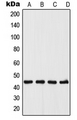 UGCG Antibody - Western blot analysis of UGCG expression in A375 (A); MCF7 (B); Raw264.7 (C); PC12 (D) whole cell lysates.