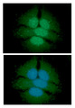 UGDH / UDPGDH Antibody - ICC/IF analysis of UGDH in HeLa cells line, stained with DAPI (Blue) for nucleus staining and monoclonal anti-human UGDH antibody (1:100) with goat anti-mouse IgG-Alexa fluor 488 conjugate (Green).
