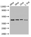 UGL Antibody - Positive WB detected in Recombinant protein;All lanes:ugl antibody at 2.8?g/ml;Secondary;Goat polyclonal to rabbit IgG at 1/50000 dilution;predicted band size: 43 KDa;observed band size: 43 KDa;