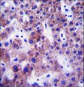 UGT1A / UGT1A1 Antibody - UGT1A1 Antibody immunohistochemistry of formalin-fixed and paraffin-embedded human liver tissue followed by peroxidase-conjugated secondary antibody and DAB staining.