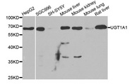 UGT1A / UGT1A1 Antibody - Western blot analysis of extracts of various cell lines, using UGT1A1 antibody.