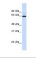 UGT1A7 Antibody - 721_B cell lysate. Antibody concentration: 1.0 ug/ml. Gel concentration: 12%.  This image was taken for the unconjugated form of this product. Other forms have not been tested.