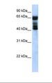 UGT2B4 Antibody - Fetal lung lysate. Antibody concentration: 1.0 ug/ml. Gel concentration: 12%.  This image was taken for the unconjugated form of this product. Other forms have not been tested.
