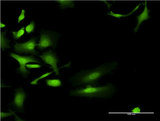 UGT2B4 Antibody - Immunofluorescence of monoclonal antibody to UGT2B4 on HeLa cell . [antibody concentration 10 ug/ml]