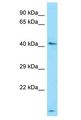 UGT3A1 Antibody - UGT3A1 antibody Western Blot of HepG2. Antibody dilution: 1 ug/ml.  This image was taken for the unconjugated form of this product. Other forms have not been tested.