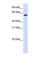 UGT8 Antibody - UGT8 antibody Western blot of Fetal Heart lysate. This image was taken for the unconjugated form of this product. Other forms have not been tested.