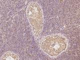 ULBP1 Antibody - Immunochemical staining of human ULBP1 in human testis with rabbit polyclonal antibody at 1:100 dilution, formalin-fixed paraffin embedded sections.