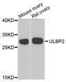 ULBP2 / RAET1H Antibody - Western blot analysis of extract of various cells.