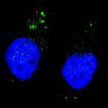 ULK1 Antibody - Fluorescent image of U251 cells stained with ULK1 (phospho S556) antibody. U251 cells were treated with Chloroquine (50 mu M,16h), then fixed with 4% PFA (20 min), permeabilized with Triton X-100 (0.2%, 30 min). Cells were then incubated ULK1 (phospho S556) primary antibody (1:200, 2 h at room temperature). For secondary antibody, Alexa Fluor 488 conjugated donkey anti-rabbit antibody (green) was used (1:1000, 1h). Nuclei were counterstained with Hoechst 33342 (blue) (10 ug/ml, 5 min). ULK1 (phospho S556) immunoreactivity is localized to autophagic vacuoles in the cytoplasm of U251 cells.