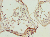 ULK4 Antibody - Immunohistochemistry of paraffin-embedded human testis tissue at dilution 1:100