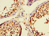 UNC13C Antibody - Immunohistochemistry of paraffin-embedded human testis tissue using UNC13C Antibody at dilution of 1:100
