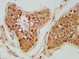 UNC5H2 / UNC5B Antibody - Immunohistochemistry image at a dilution of 1:300 and staining in paraffin-embedded human testis tissue performed on a Leica BondTM system. After dewaxing and hydration, antigen retrieval was mediated by high pressure in a citrate buffer (pH 6.0) . Section was blocked with 10% normal goat serum 30min at RT. Then primary antibody (1% BSA) was incubated at 4 °C overnight. The primary is detected by a biotinylated secondary antibody and visualized using an HRP conjugated SP system.