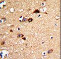 UNC5H3 / UNC5C Antibody - Formalin-fixed and paraffin-embedded human brain tissue with UNC5C Antibody , which was peroxidase-conjugated to the secondary antibody, followed by DAB staining. This data demonstrates the use of this antibody for immunohistochemistry; clinical relevance has not been evaluated.