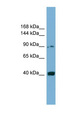 UNC5H3 / UNC5C Antibody - UNC5C antibody Western blot of COLO205 cell lysate. This image was taken for the unconjugated form of this product. Other forms have not been tested.