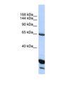 UNC5H3 / UNC5C Antibody - Western blot of Human HepG2. UNC5C antibody dilution 1.0 ug/ml.  This image was taken for the unconjugated form of this product. Other forms have not been tested.