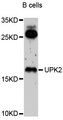 UPK2 / UPII / Uroplakin 2 Antibody - Western blot analysis of extracts of B-cell cells, using UPK2 antibody at 1:1000 dilution. The secondary antibody used was an HRP Goat Anti-Rabbit IgG (H+L) at 1:10000 dilution. Lysates were loaded 25ug per lane and 3% nonfat dry milk in TBST was used for blocking. An ECL Kit was used for detection and the exposure time was 40s.