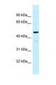 UQCRC1 Antibody - UQCRC1 antibody Western blot of Fetal Kidney lysate. Antibody concentration 1 ug/ml.  This image was taken for the unconjugated form of this product. Other forms have not been tested.