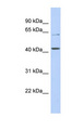 URAT1 / SLC22A12 Antibody - SLC22A12 antibody Western blot of DU145 cell lysate. This image was taken for the unconjugated form of this product. Other forms have not been tested.