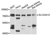 URAT1 / SLC22A12 Antibody - Western blot analysis of extracts of HepG2 cells.