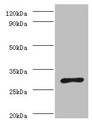 ureA / Urease Alpha Antibody - Western blot All lanes: Urease subunit alpha antibody at 2µg/ml + Helicobacter pylori bacteria liquidSecondary Goat polyclonal to rabbit IgG at 1/10000 dilution Predicted band size: 27 kDa Observed band size: 27 kDa