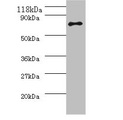 ureB / Urease Beta Antibody - Western blot All lanes: Urease subunit antibody at 2µg/ml + 293T whole cell lysate Secondary Goat polyclonal to rabbit IgG at 1/10000 dilution Predicted band size: 62 kDa Observed band size: 62 kDa