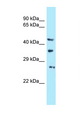 USB1 Antibody - C16orf57 antibody Western blot of PANC1 Cell lysate. Antibody concentration 1 ug/ml.  This image was taken for the unconjugated form of this product. Other forms have not been tested.