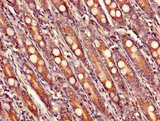 USHBP1 Antibody - Immunohistochemistry of paraffin-embedded human small intestine tissue using USHBP1 Antibody at dilution of 1:100