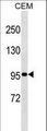 USP1 Antibody - USP1 Antibody western blot of CEM cell line lysates (35 ug/lane). The USP1 antibody detected the USP1 protein (arrow).