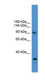 USP13 Antibody - USP13 antibody Western blot of Placenta lysate. This image was taken for the unconjugated form of this product. Other forms have not been tested.