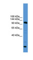 USP15 Antibody - USP15 antibody Western blot of Jurkat lysate. This image was taken for the unconjugated form of this product. Other forms have not been tested.