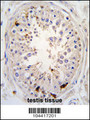 USP2 Antibody - Formalin-fixed and paraffin-embedded human testis tissue reacted with USP2 antibody (C-term L523), which was peroxidase-conjugated to the secondary antibody, followed by DAB staining. This data demonstrates the use of this antibody for immunohistochemistry; clinical relevance has not been evaluated.