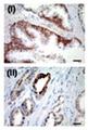 USP2 Antibody - IHC for USP2a in a formalin-fixed, paraffin-embedded human prostate sample. Cytoplasmic positive immunostaining was detected in tumor glands (ii), whereas in normal prostatic epithelium, USP2a expression was restricted to the basal layer.