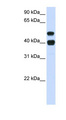 USP22 Antibody - USP22 antibody Western blot of Fetal Heart lysate. This image was taken for the unconjugated form of this product. Other forms have not been tested.