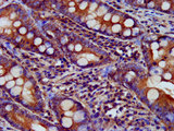 USP24 Antibody - Immunohistochemistry image at a dilution of 1:200 and staining in paraffin-embedded human small intestine tissue performed on a Leica BondTM system. After dewaxing and hydration, antigen retrieval was mediated by high pressure in a citrate buffer (pH 6.0) . Section was blocked with 10% normal goat serum 30min at RT. Then primary antibody (1% BSA) was incubated at 4 °C overnight. The primary is detected by a biotinylated secondary antibody and visualized using an HRP conjugated SP system.