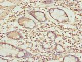 USP26 Antibody - Immunohistochemistry of paraffin-embedded human small intestine tissue at dilution 1:100