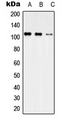 USP35 Antibody - Western blot analysis of USP35 expression in HEK293T (A); Raw264.7 (B); H9C2 (C) whole cell lysates.