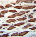 USP45 Antibody - USP45 Antibody immunohistochemistry of formalin-fixed and paraffin-embedded human skeletal muscle followed by peroxidase-conjugated secondary antibody and DAB staining.