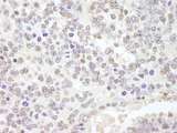 USP47 Antibody - Detection of Mouse USP47 by Immunohistochemistry. Sample: FFPE section of mouse teratoma. Antibody: Affinity purified rabbit anti-USP47 used at a dilution of 1:250.