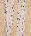 USP47 Antibody - Antibody staining USP47 in human skeletal muscle tissue sections by Immunohistochemistry (IHC-P - paraformaldehyde-fixed, paraffin-embedded sections). Tissue was fixed with formaldehyde and blocked with 3% BSA for 0. 5 hour at room temperature; antigen retrieval was by heat mediation with a citrate buffer (pH 6). Samples were incubated with primary antibody (1:25) for 1 hours at 37°C. A undiluted biotinylated goat polyvalent antibody was used as the secondary antibody.