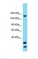 USP54 Antibody - Western blot of Human THP-1 . USP54 antibody dilution 1.0 ug/ml.  This image was taken for the unconjugated form of this product. Other forms have not been tested.